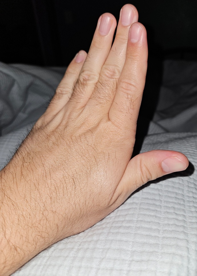 Are you happy with the way your fingers look?