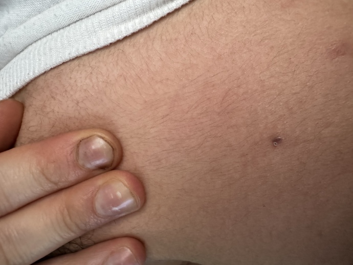What could this be? its so painful affecting my whole back?