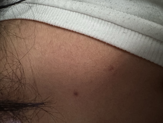 What could this be? its so painful affecting my whole back?
