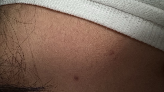 What could this be? its so painful affecting my whole back?
