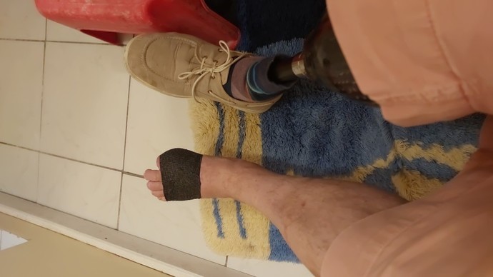 My foot is injured. How does it heal?
