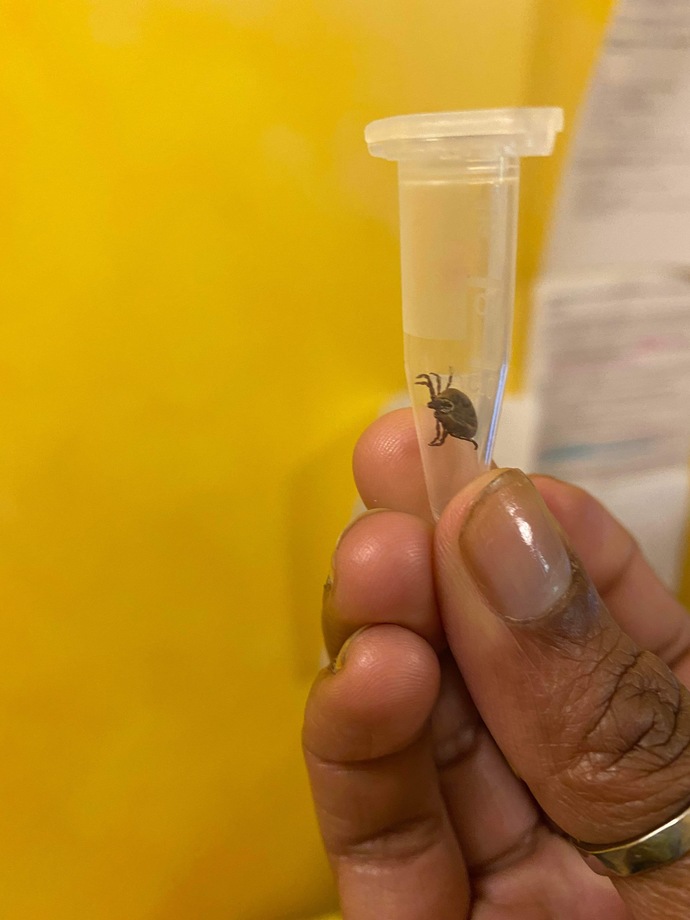 Have you ever gotten a tick?