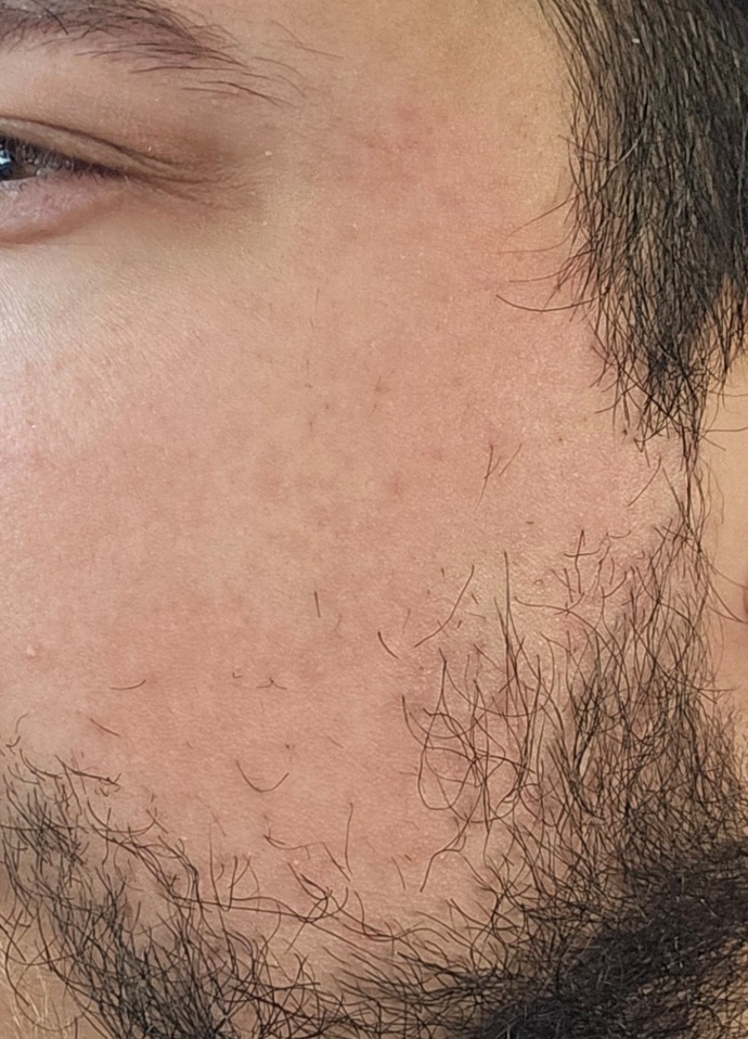 Does cheeks like this turn you off, is it unattractive?