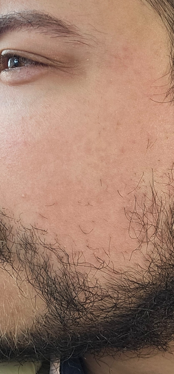 Does cheeks like this turn you off, is it unattractive?