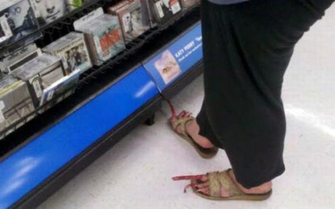 Nasty toenails