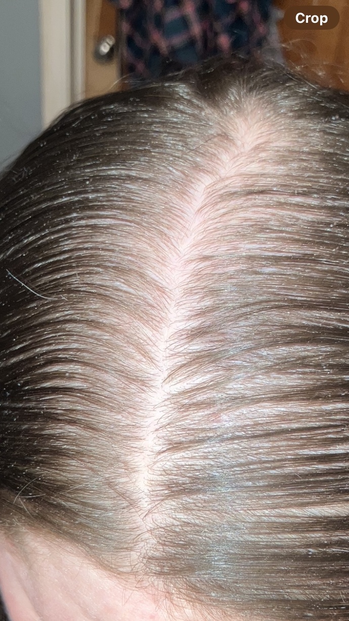 Is this fixable at 26?