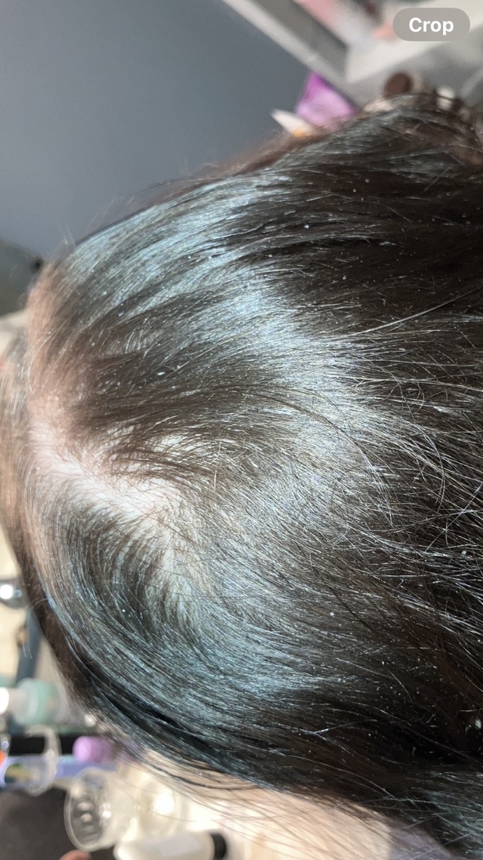 Is this fixable at 26?