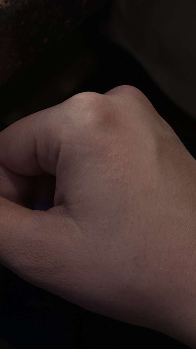 Anyone have any clue what these dots in my hand can be?