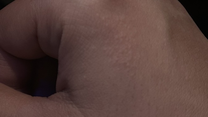 Anyone have any clue what these dots in my hand can be?