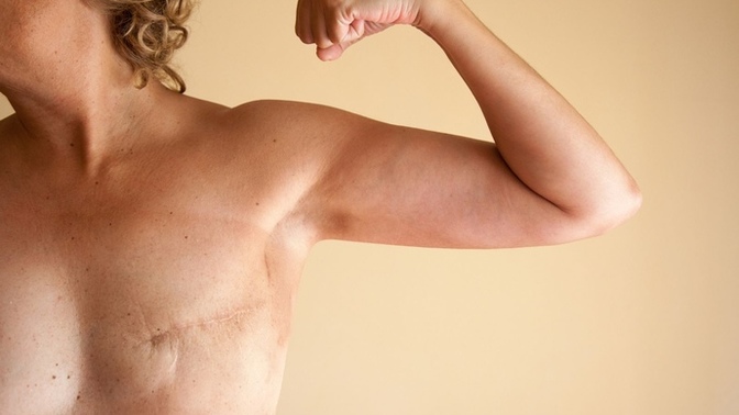 Are you embarrassed by or empowered by your physical scars? More importantly why?