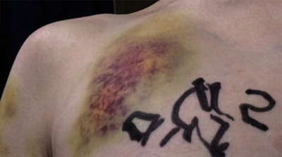 Do you have a high pain tolerance?