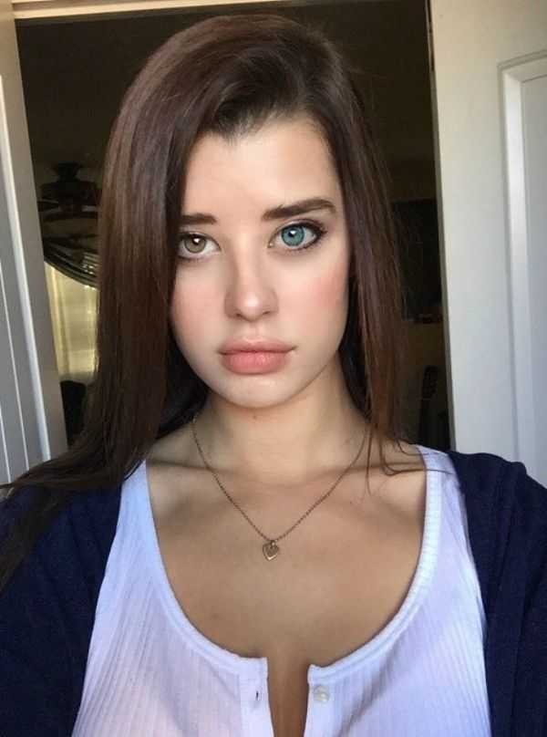 Have you ever seen or known someone with two different eye colors?