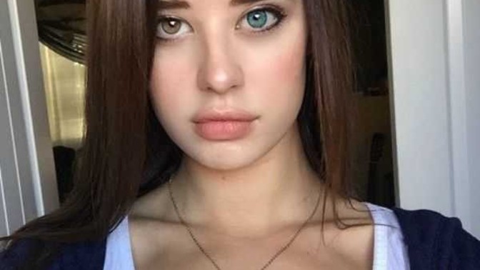 Have you ever seen or known someone with two different eye colors?