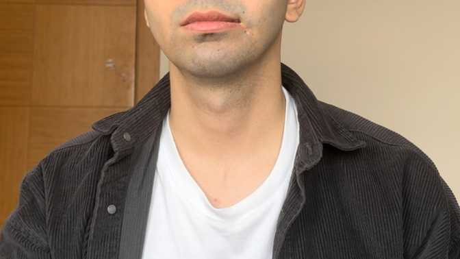 Girls, Several months ago ı had a accident and now I have a scar on the left side of my lips? does it look that bad?