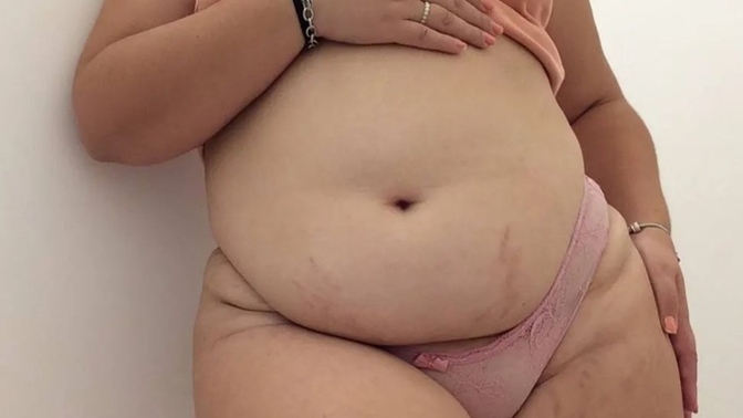 Do you think it's possible to make my stretchmarks dissapear or make them less visible?