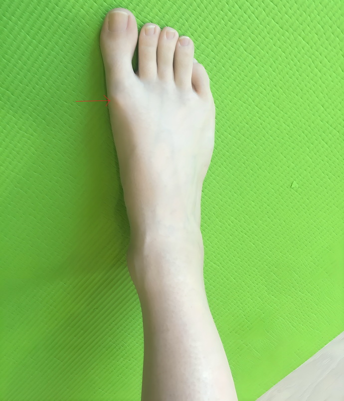 Is this arthrosis?