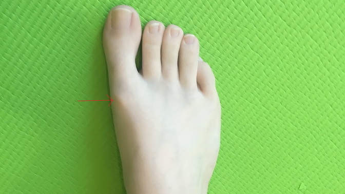 Is this arthrosis?