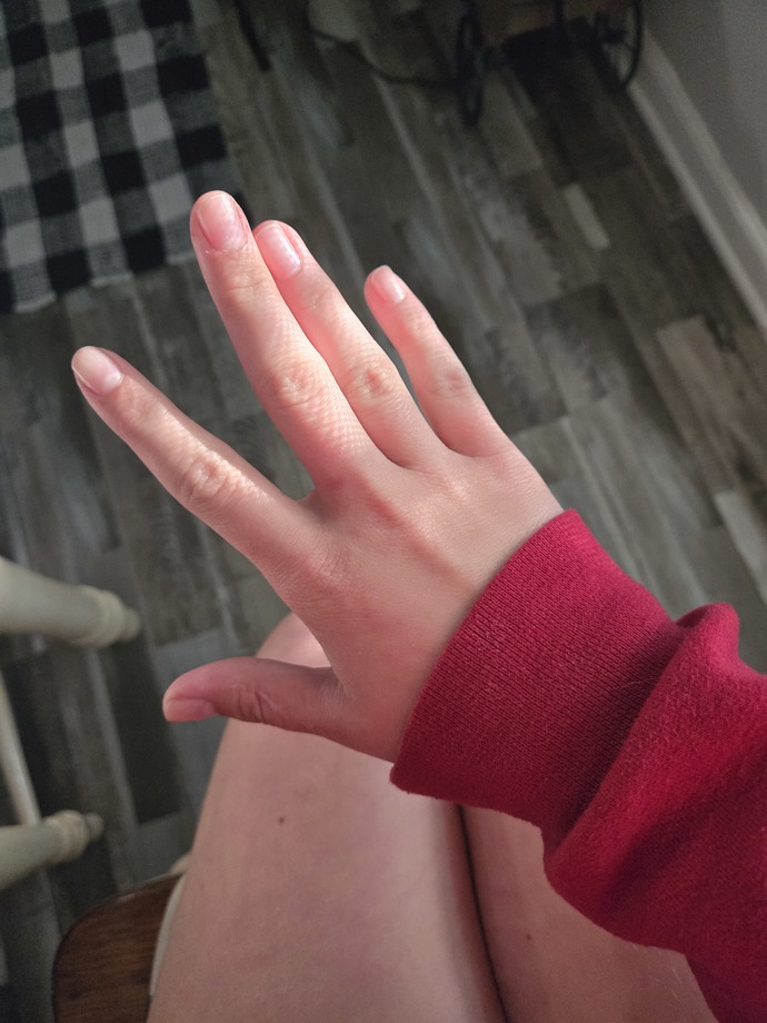 Fingas