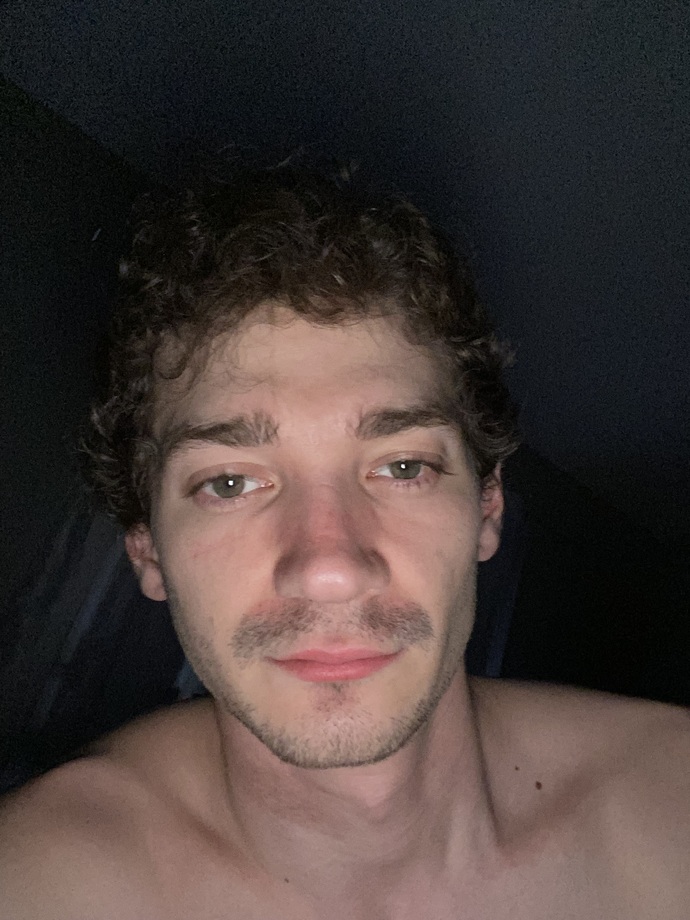 If I got a nose job would I look better or still ugly?