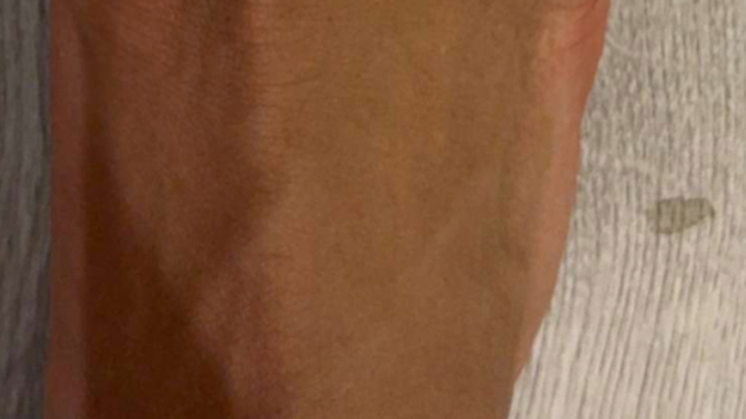 My foot is injured. How does it heal?