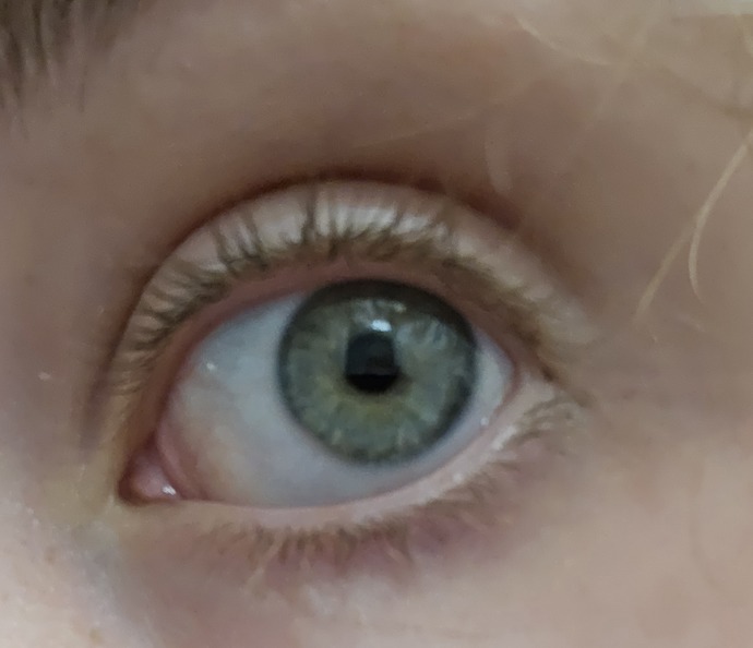 This is my eyeball, pretty sure its a weird dark green aquamarine? Its not quite green
