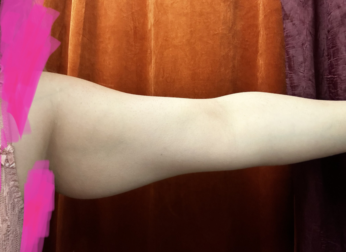 What do you think of girls with fat arms?