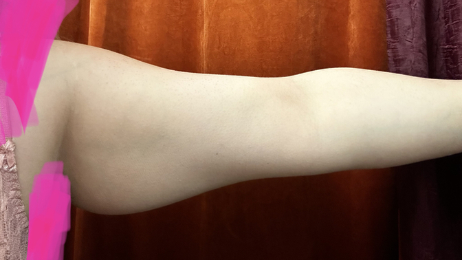 What do you think of girls with fat arms?