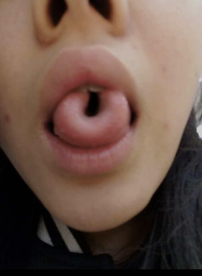 Can you roll your tongue?