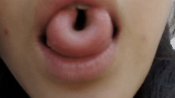 Can you roll your tongue?