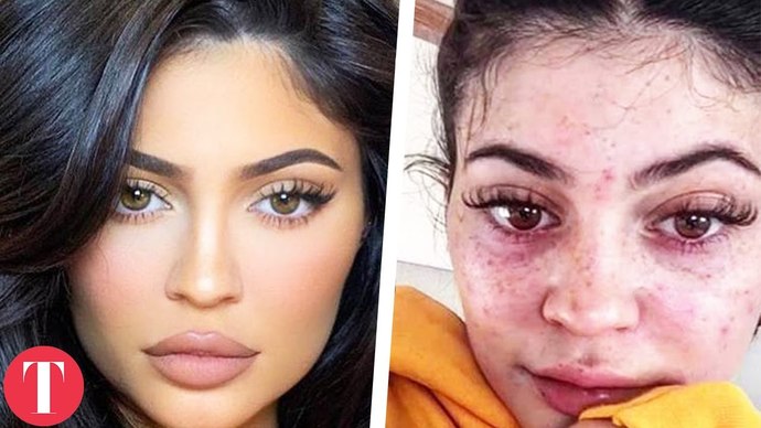 How do celebrities have a flawless face every time?