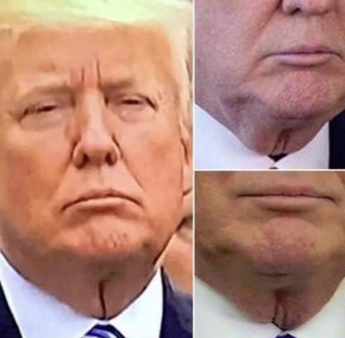 Are you able to unsee Trumps neck vulva?