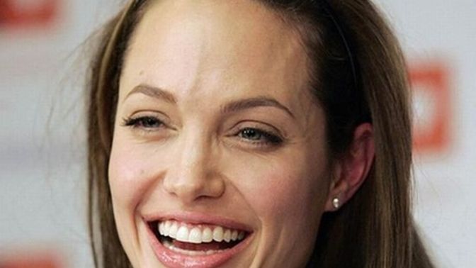 Are slightly big foreheads a turnoff for you, on the opposite gender?