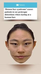 What do you think about demon face syndrome ? - GirlsAskGuys