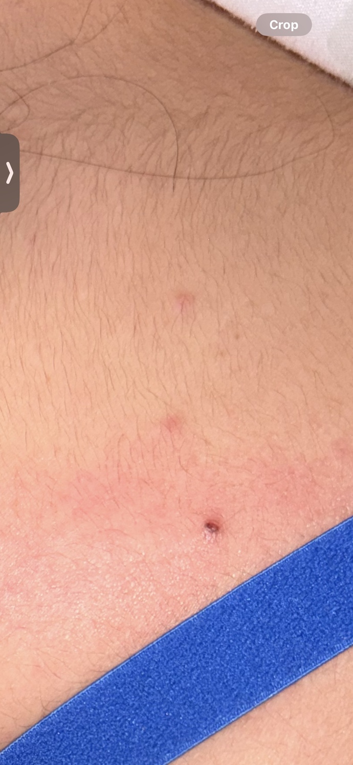 Ok so I have had a chest xray very recently everything is normal however?