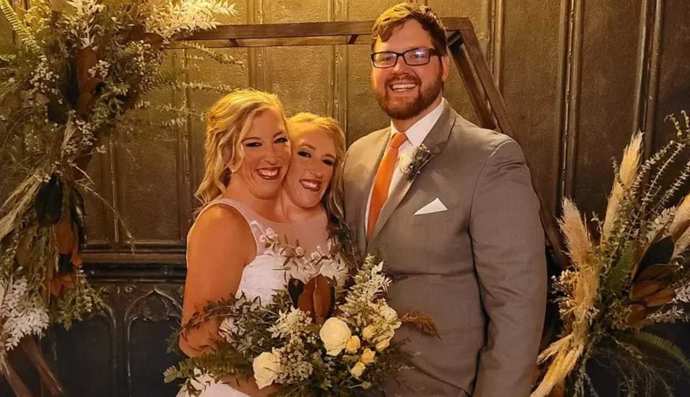 What do you think about the conjoined twin Abby and Brittanys marriage?