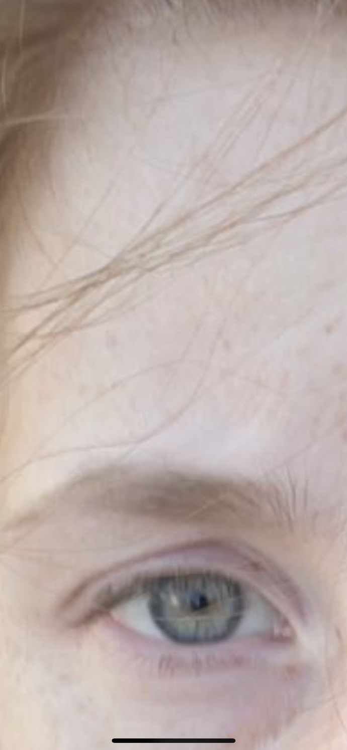 Do I have a cool or warm skin undertone?