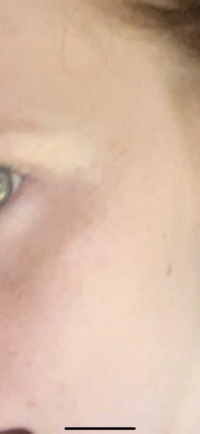 Do I have a cool or warm skin undertone?