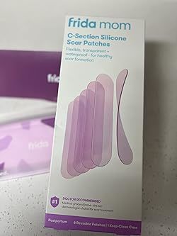C-section experiences: If you’ve had one, or if your partner/wife has had one?