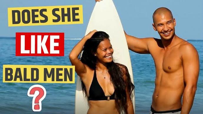 Can you be attracted to a man having hairloss?
