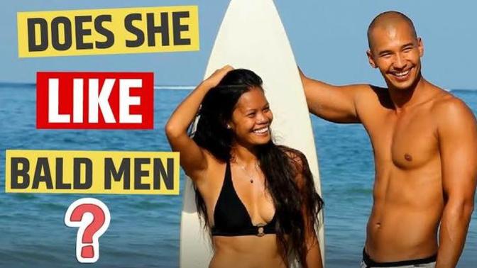 Can you be attracted to a man having hairloss?