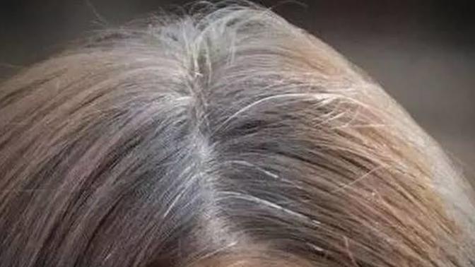 Is there any way to stop the hair from turning white?