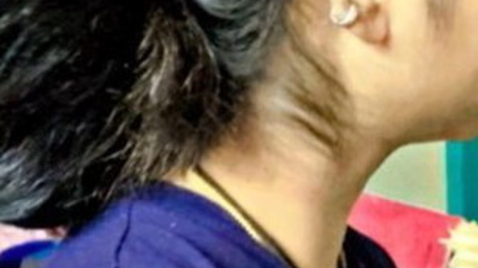 What is one word for this part of my hair?