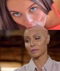 How do you think about girls with bald head?