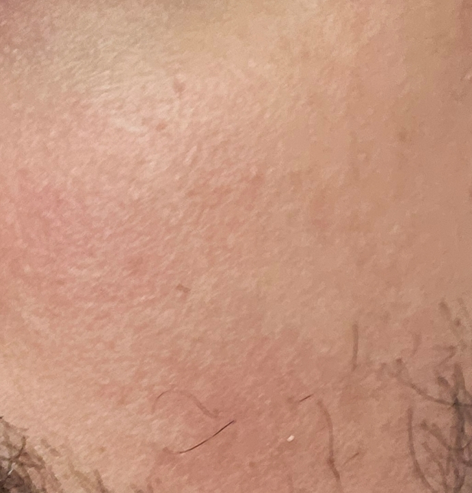 Is red cheeks on a guy unattractive and would it put you off?