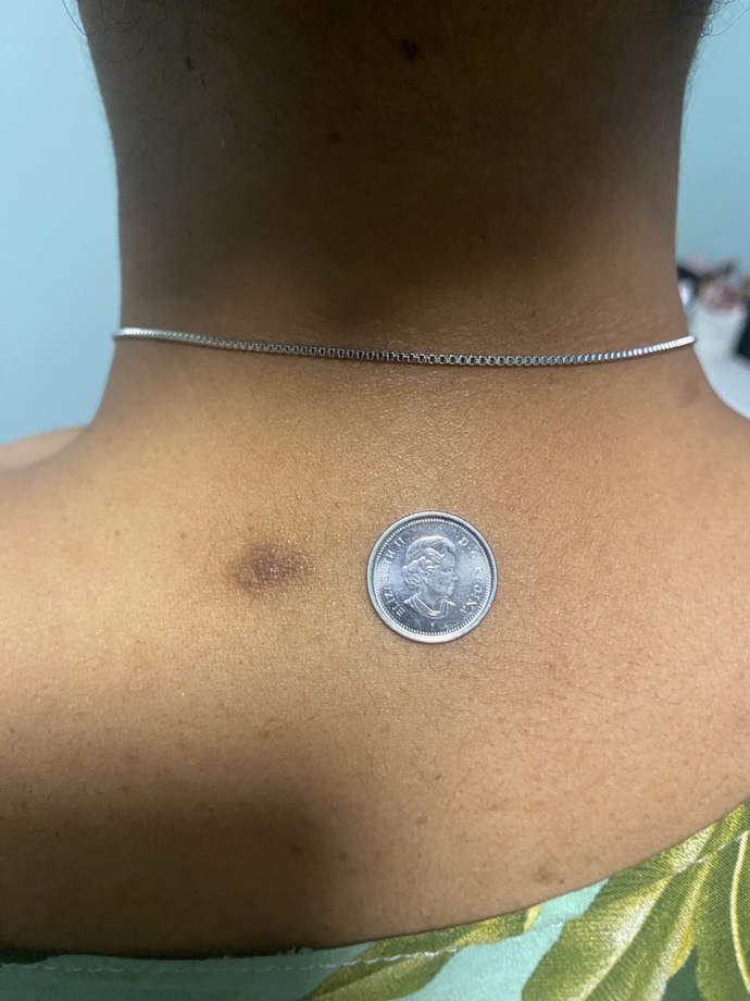 I have cancer! What am I going to do?