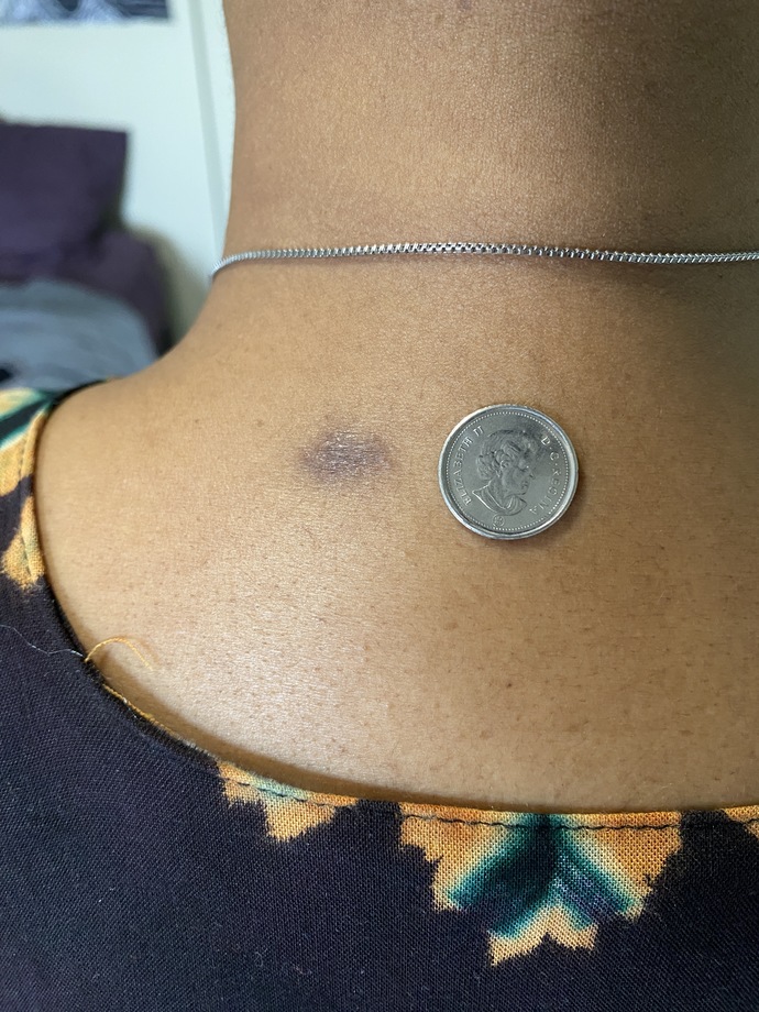 I have cancer! What am I going to do?