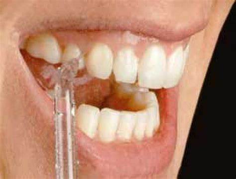 How do you remove FOOD PARTICLES from between your TEETH?