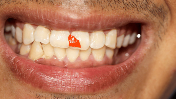 How do you remove FOOD PARTICLES from between your TEETH?