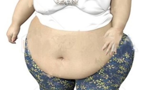 Am I wrong for telling my obese girlfriend to loose weight?