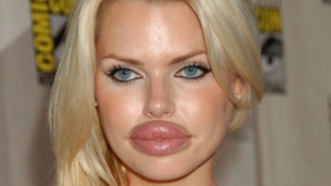 Why do beautiful women DESTROY their looks with cosmetic surgery?